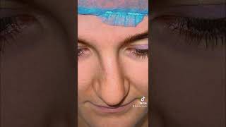 تجميل الانف قبل و بعد العمليه باسبوع …rhinoplasty before and after