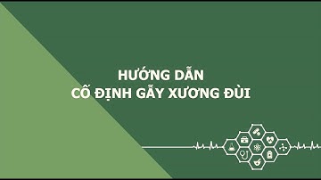 Hướng dẫn cố định gẫy xương đùi | Bệnh viện Quân y 103