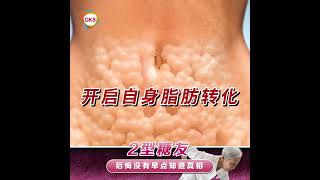 2型糖尿病是胰岛素问题还是内脏脂肪？为什么吃降糖药还是反反复复？