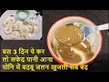 सफ़ेद पानी का इलाज White Discharge home remedy in Hindi , Swet pradar ka ilaj, Leucorrhoea treatment