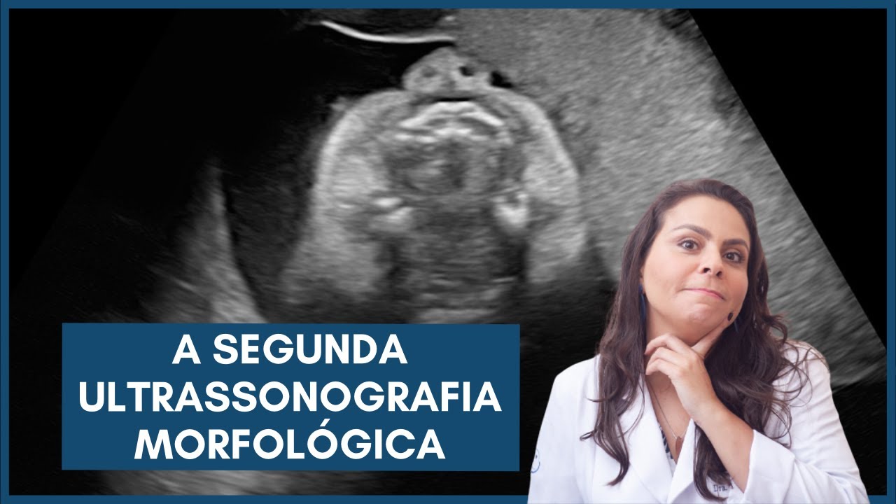 A segunda ultrassonografia morfológica - Dra. Maíra de La Rocque