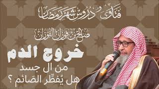 خروج الدم من الجسد هل يُفطِر الصائم العلامة الشيخ صالح الفوزان