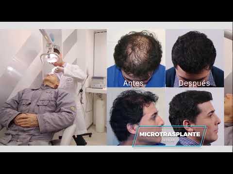Estética Capilar en Clínica Nahás Estética Capilar en Clínica Nahás