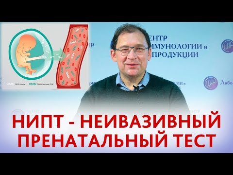 Бейне: Нипце не ойлап тапты?