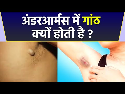 वीडियो: आर्मर के नीचे क्या है?