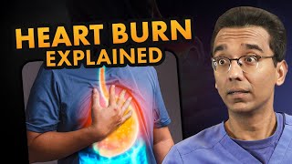 Say Goodbye to Heartburn: The Complete Guide to FIX Heartburn (GERD) & Acid Reflux
