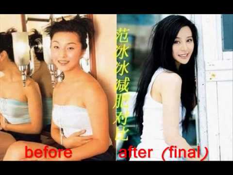 fan bing bingplastic surgery chinese