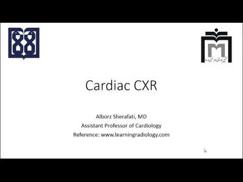تشخیص بیماری های قلبی در رادیوگرافی قفسه سینه 