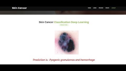 Skin Cancer Prediction Using Deep Learning Techniques | Python Machine Learning IEEE Project