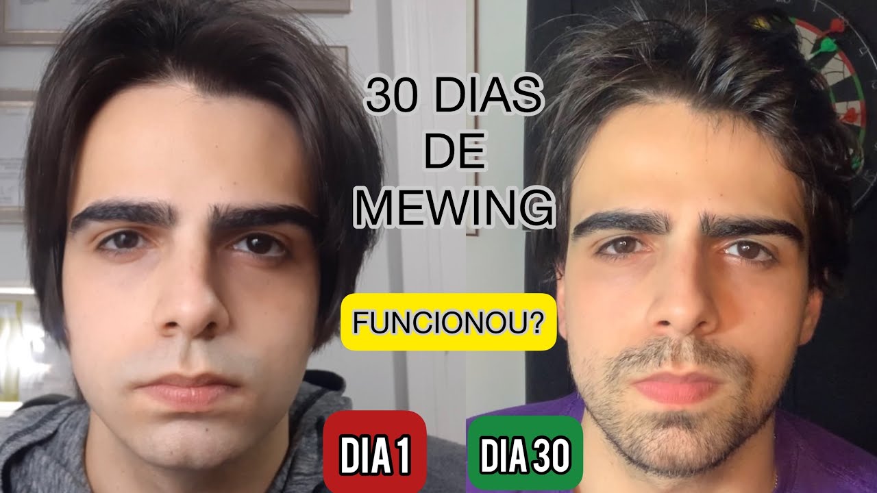 Mewing: A Técnica para Definir o Rosto!