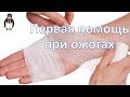 Первая помощь при ожогах