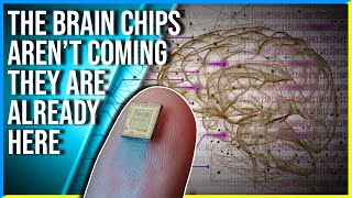 Video: Transhumanism: US FDA Approves use of Microchip Implants - Jason Bermas