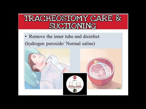 tracheostomy care