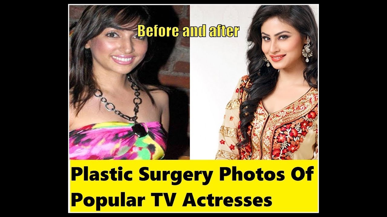 8 Plastic Surgery Photos Of Popular TV Actresses - BEFORE & AFTER |2018