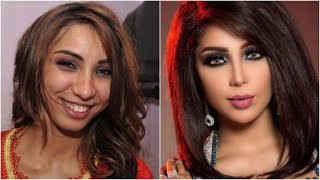 فضائح الفنانين العرب فنانات قبل وبعد التجميل.. لن تصدّقوا الفرق( صور )هل عمليات التجميل لم تعد  عيب