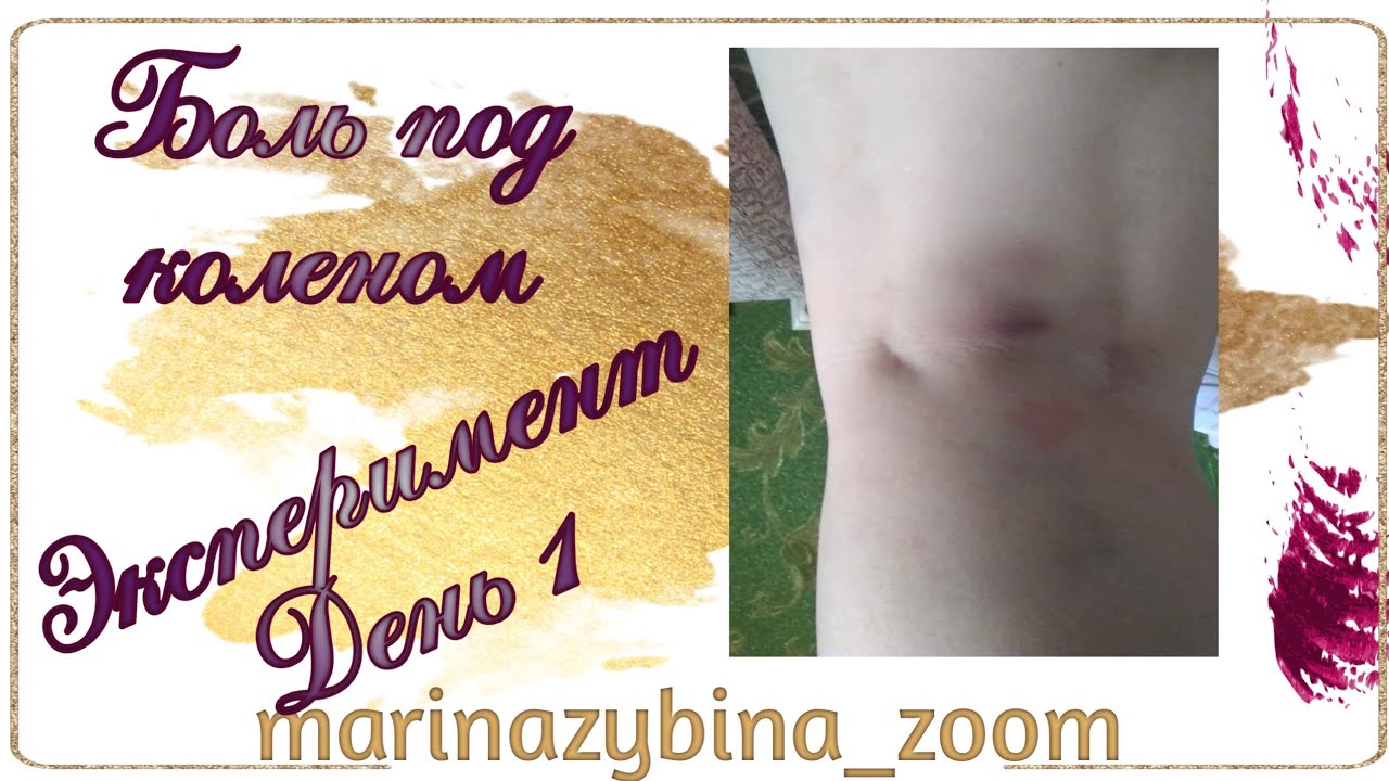 Боль в коленке сзади. Лимфоузел. Киста. Плоскостопие