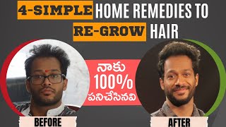4 simple home remedies that worked for me to regrow hair in Telugu