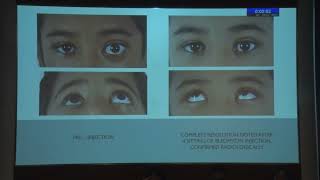 Aioc2022 Fp1130 Orbit I Topicefficacy Of Intralesional Bleomycin In Treatment Of Orbital Lymphan