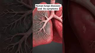 lungs diseases and symptoms #healthtips #facts