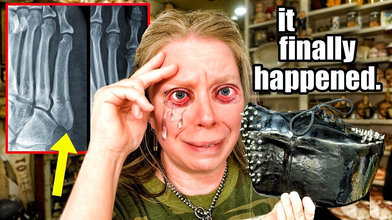 You'll Never Guess How I Broke My Foot (Storytime)