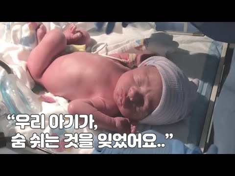 우리 아기가, 숨 쉬는 것을 잊었어요.. (feat. 마이클)