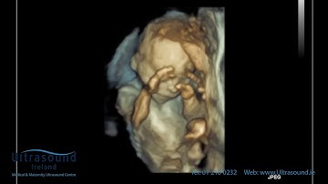 Scan of the Week: 22 Week Well Baby Scan