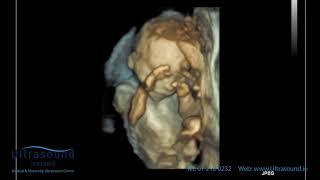 Scan of the Week: 22 Week Well Baby Scan