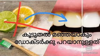 Pallu velukkan | Teeth whitening at home malayalam / teeth cleaning / dont do this / pallu velukkan