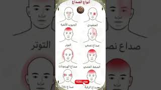 Identify Your Headache 🧠 أنواع الصداع | Kopfschmerzen | Dolor de cabeza | ปวดหัว