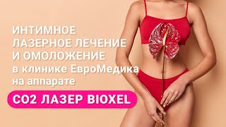 Лечение интимных женских проблем с помощью СО2 лазера в клинике ЕвроМедика