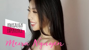 [Official] Invisalign experience❤️ Kinh nghiệm niềng răng Invisalign ❤️ Meira Nguyen