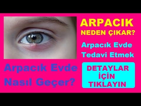 Video: Aqrafiya necə müalicə olunur?