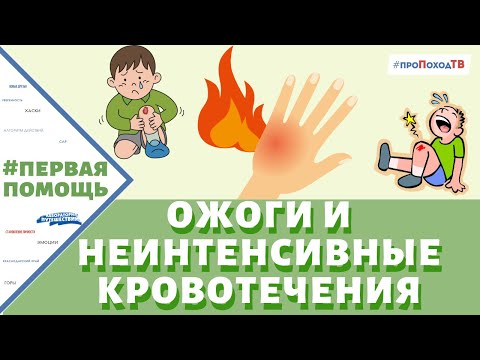 ОЖОГИ, РАНЫ, ЦАРАПИНЫ. ПЕРВАЯ ПОМОЩЬ