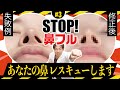STOP鼻フル！美鼻の最終形と驚きのビフォーアフター【第3話】