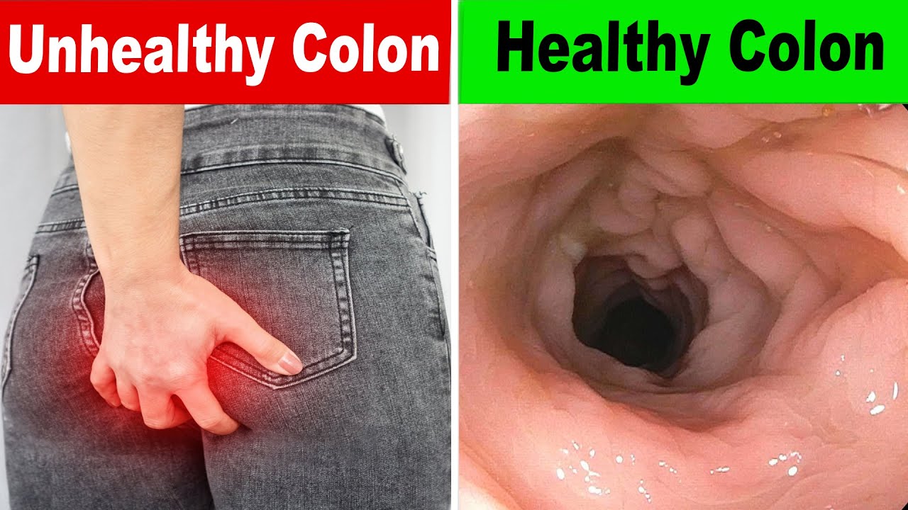 ⁣12 Effective Ways You Can Maintain A Healthy Colon