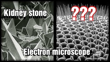 Electron microscope images ||Top 15    Best Electron microscope images || stunning microscope images