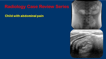 Intussusception Video