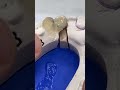 Dental Videos From around the World 9