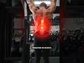 Stop Doing Decompression for Disc Herniation (Do This Instead)