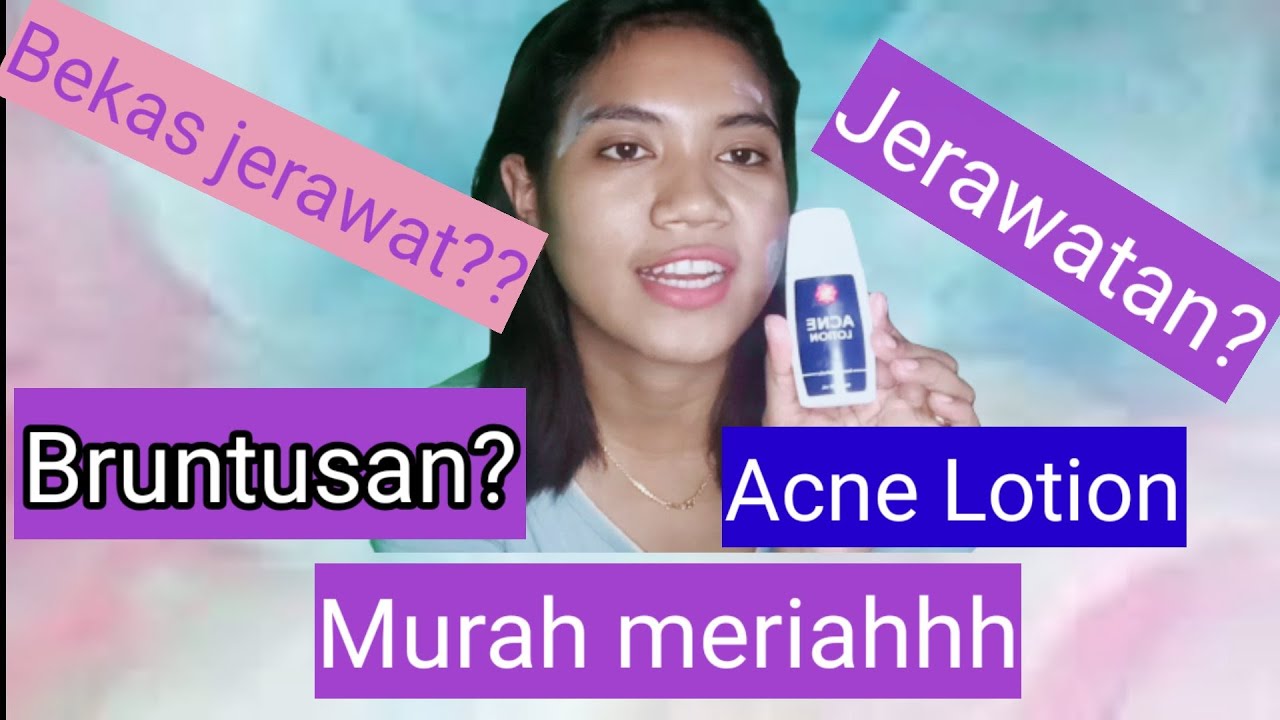 Review Acne lotion Viva untuk jerawat Benaran ampuh?? YouTube