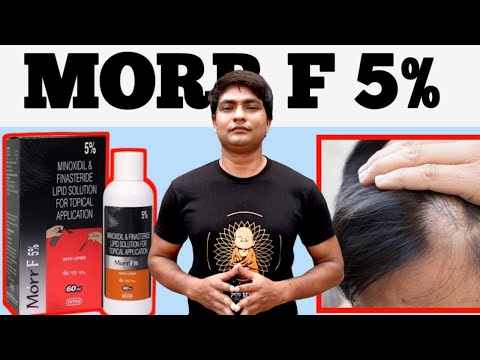 morr f 5 results | morr f 5 review | morr f 5 uses in hindi | morr f 5 minoxidil and finasteride
