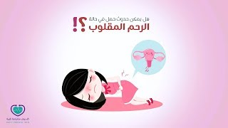 هل الرحم المقلوب يمنع الحمل (حقيقة أم لا)؟