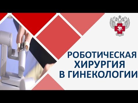 Гинекологические операции. 🤖 Применение роботического комплекса в гинекологических операциях.