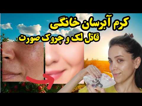 کرم آبرسان روشن کننده ضدلک و ضدچروک خانگی ۱۰ سال جوان تر شو خداحافظی با چروک صورت با کرم آبرسان