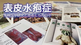 表皮水疱症 先端医学研究と患者たちの日々｜Science Portal動画ニュース（2022年5月16日配信）