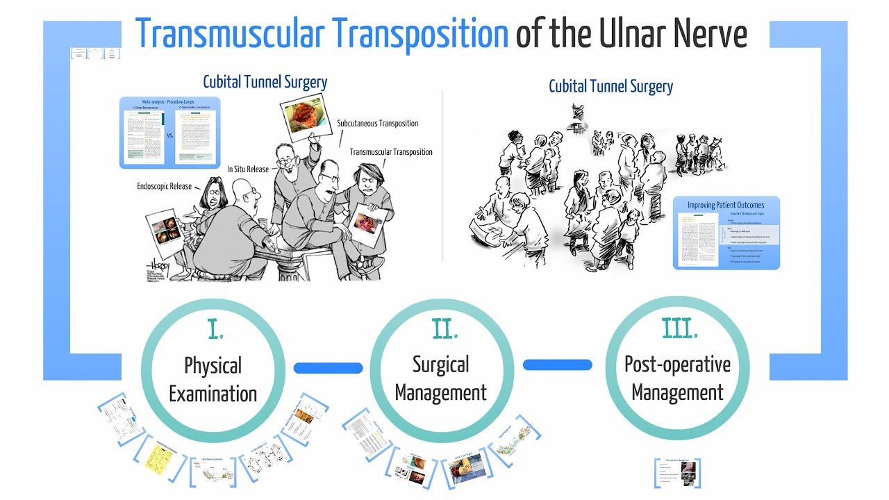 Transmuscular Ulnar Nerve Transposition Feat Dr Mackinnon YouTube transmuscular-ulnar-nerve-transposition-feat-dr-mackinnon-youtube
