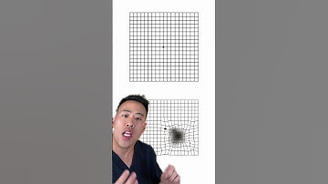 Vision test for #maculardegeneration #blind #ophthalmology