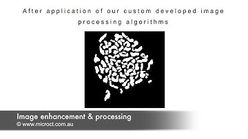 CT image processing
