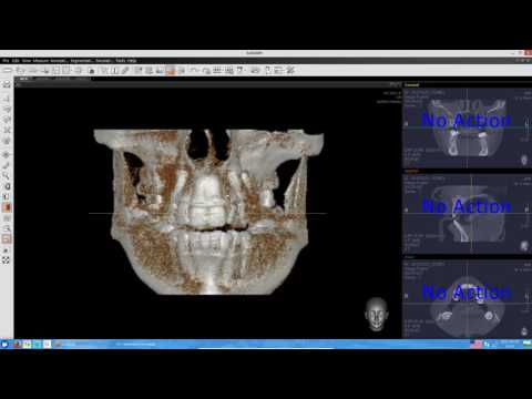 EZ3D2009 (просмотр КТ) - инструкция пользователя