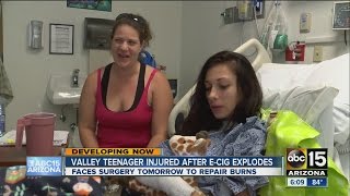 Valley teen injured after e-cig explodes